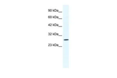 Anti-CLIC1 antibody, N-term used in Western Blot (WB). GTX48722