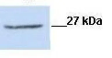 Anti-CLIC1 antibody, N-term used in Western Blot (WB). GTX48722