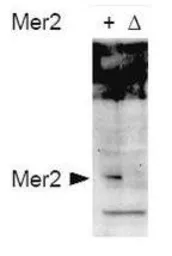 Anti-Mer2 (phospho Ser30) antibody used in Western Blot (WB). GTX48730