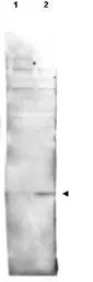 Anti-Histone H2A.vS137ph (phospho Ser137) antibody used in Western Blot (WB). GTX48733