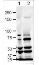 Anti-SLIT1 antibody used in Western Blot (WB). GTX48742