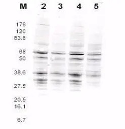 Anti-Rfa2 (Pan Reactive) antibody used in Western Blot (WB). GTX48746