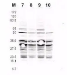 Anti-Rfa2 (phospho Ser122) antibody used in Western Blot (WB). GTX48747