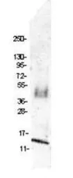 Anti-MIP1 beta antibody used in Western Blot (WB). GTX48752