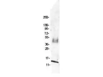 Anti-MIP1 beta antibody used in Western Blot (WB). GTX48752