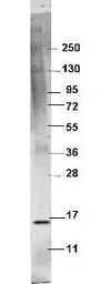 Anti-TNF alpha antibody used in Western Blot (WB). GTX48753