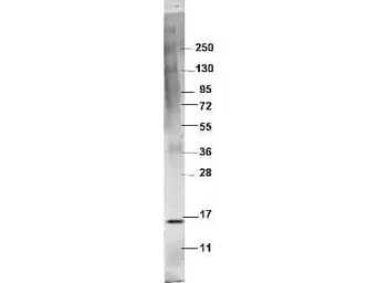 Anti-TNF alpha antibody used in Western Blot (WB). GTX48753