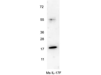 Anti-IL17F antibody used in Western Blot (WB). GTX48759