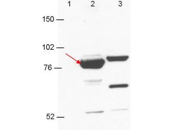 Anti-Esrp-1/2 antibody [23A7.C9] used in Western Blot (WB). GTX48760