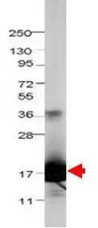 Anti-IL1F5 antibody used in Western Blot (WB). GTX48763