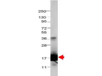 Anti-IL1F5 antibody used in Western Blot (WB). GTX48763
