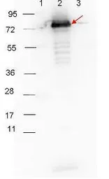 Anti-Surface Lipoprotein P27 antibody used in Western Blot (WB). GTX48799