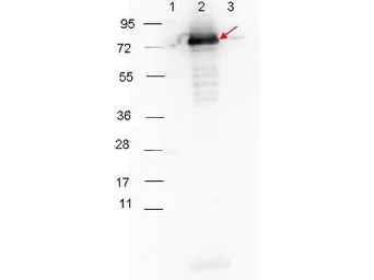 Anti-Surface Lipoprotein P27 antibody used in Western Blot (WB). GTX48799