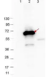 Anti-CRASP-2 antibody used in Western Blot (WB). GTX48800