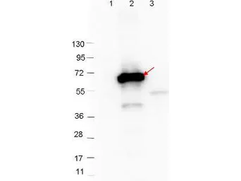 Anti-CRASP-2 antibody used in Western Blot (WB). GTX48800