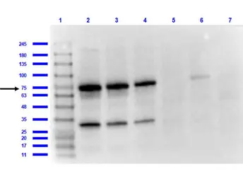 Anti-Borrelia burgdorferi Osp A antibody used in Western Blot (WB). GTX48804
