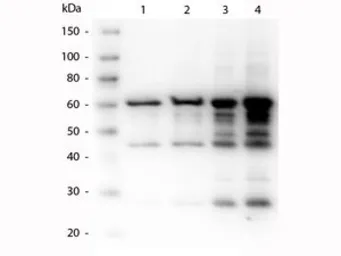 Anti-Borrelia burgdorferi p35 antibody used in Western Blot (WB). GTX48805