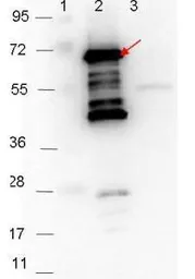 Anti-Borrelia burgdorferi p35 antibody used in Western Blot (WB). GTX48805