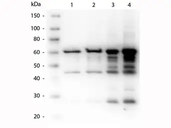 Anti-Borrelia burgdorferi p35 antibody used in Western Blot (WB). GTX48805