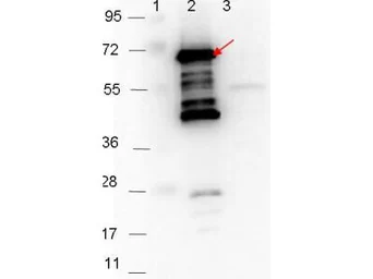 Anti-Borrelia burgdorferi p35 antibody used in Western Blot (WB). GTX48805