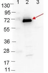 Anti-Borrelia burgdorferi Osp C antibody used in Western Blot (WB). GTX48806