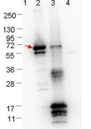 Anti-Borrelia burgdorferi Erpn/Ospe antibody used in Western Blot (WB). GTX48807