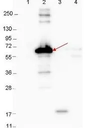 Anti-Borrelia burgdorferi Dbp-A antibody used in Western Blot (WB). GTX48809