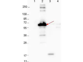 Anti-Borrelia burgdorferi Dbp-A antibody used in Western Blot (WB). GTX48809