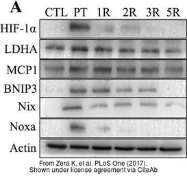 Anti-MCP1 / CCL2 antibody used in Western Blot (WB). GTX48813