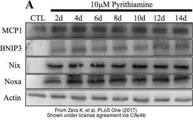 Anti-MCP1 / CCL2 antibody used in Western Blot (WB). GTX48813