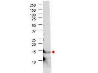 Anti-IL21 antibody used in Western Blot (WB). GTX48814