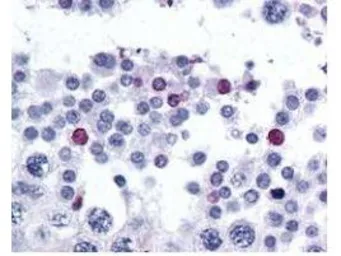 Anti-SPANXC antibody used in IHC (Paraffin sections) (IHC-P). GTX48817