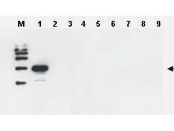 Anti-Ulp1 antibody used in Western Blot (WB). GTX48820