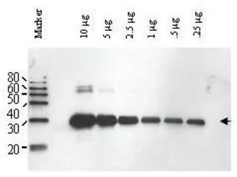 Anti-Ulp1 antibody used in Western Blot (WB). GTX48820