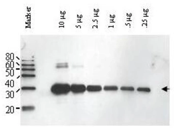 Anti-Ulp1 antibody used in Western Blot (WB). GTX48820
