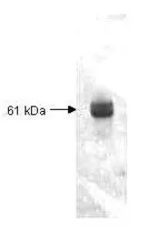 Anti-Carboxypeptidase Y antibody used in Western Blot (WB). GTX48866