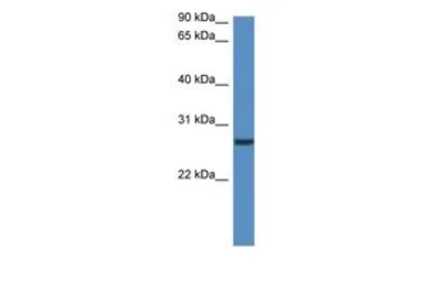 Anti-CLEC1B antibody, N-term used in Western Blot (WB). GTX48892