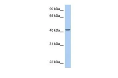 Anti-ARID3C antibody, C-term used in Western Blot (WB). GTX48903