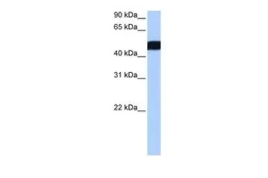 Anti-CROCCP3 antibody, N-term used in Western Blot (WB). GTX48906