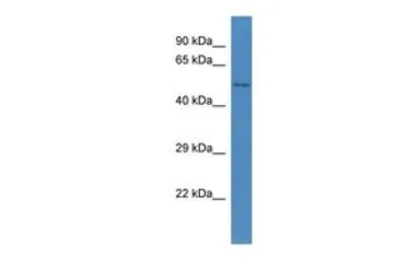 Anti-CCBE1 antibody, C-term used in Western Blot (WB). GTX48909