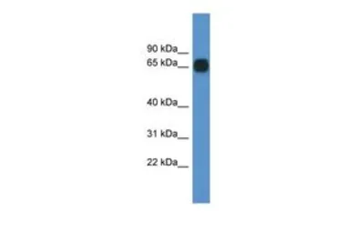 Anti-CPNE6 antibody, C-term used in Western Blot (WB). GTX48926