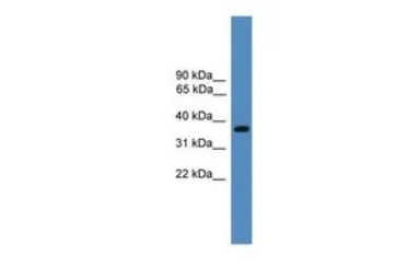 Anti-BSND antibody, Internal used in Western Blot (WB). GTX48927