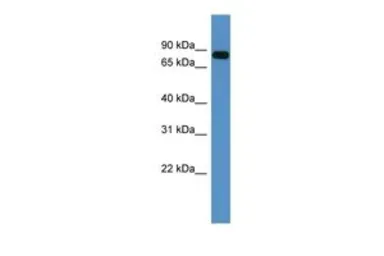 Anti-COL9A3 antibody, C-term used in Western Blot (WB). GTX48928