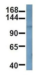 Anti-ANKRD27 antibody, C-term used in Western Blot (WB). GTX48931