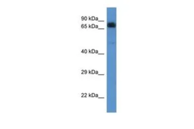 Anti-ACAD9 antibody, C-term used in Western Blot (WB). GTX48933