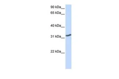 Anti-DLX3 antibody, N-term used in Western Blot (WB). GTX48941