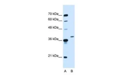 Anti-HOXD11 antibody, Internal used in Western Blot (WB). GTX48946