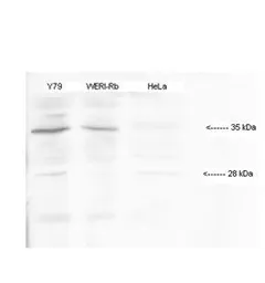 Anti-HMX1 antibody, Internal used in Western Blot (WB). GTX48949