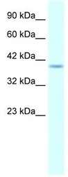 Anti-HMX1 antibody, Internal used in Western Blot (WB). GTX48950