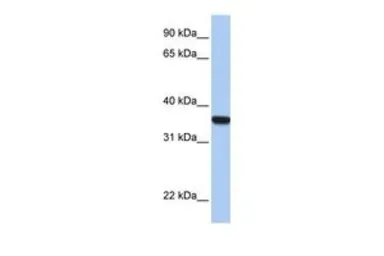 Anti-HOXD1 antibody, C-term used in Western Blot (WB). GTX48951